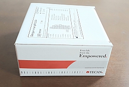 Dengue virus IgM ELISA