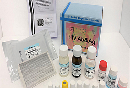 HIV Ab&Ag – ELISA