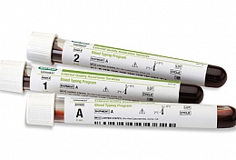 EQAS Blood Typing Program