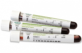 EQAS Blood Typing Program