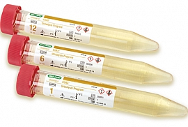 EQAS Urinalysis Program