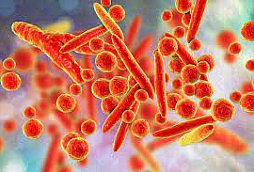 Mycoplasma pneumoniae