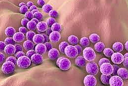 Staphylococcus aureus subsp. aureus derived from ATCC® 25923™