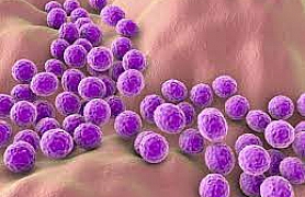 Staphylococcus aureus subsp. aureus derived from ATCC® 25923™